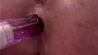 Anal Masturbate and Anal Grape Moving - porn video